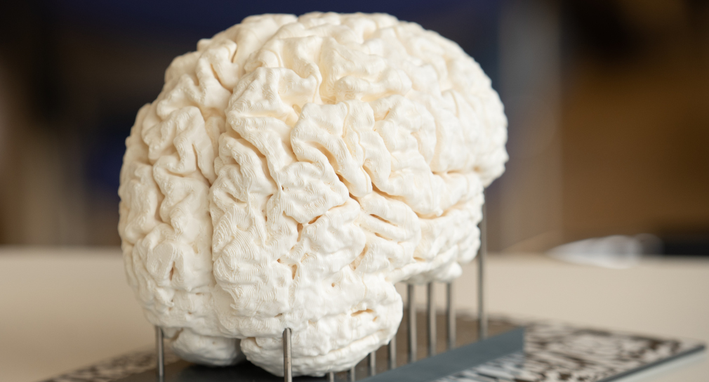 3D-Druck: weißes Gehirn
