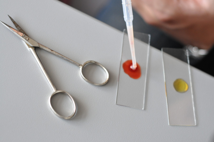 Link zur ZSL-Seite „BNT“; Foto: Eine Schere liegt neben zwei Objektträgern mit bunten Flüssigkeitstropfen.