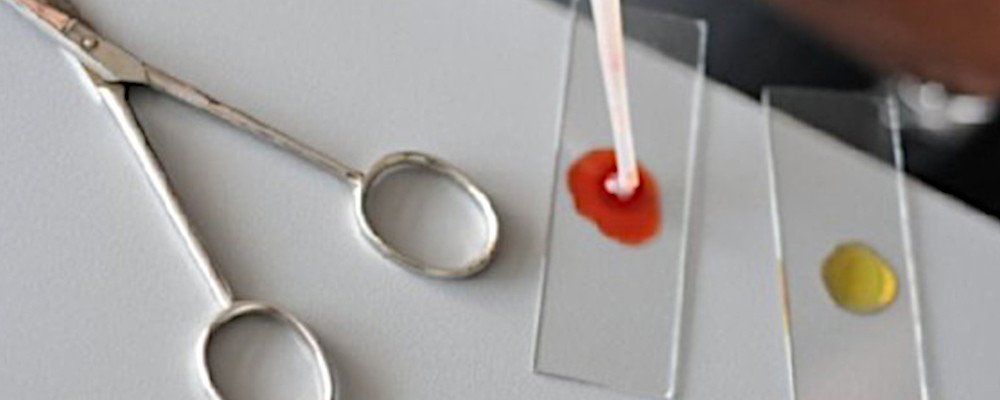 Experimentieren im BNT-Unterricht (Foto: auf einem Tisch eine Schere und zwei Glasplättchen mit rotem und gelbem Farbtupfer)